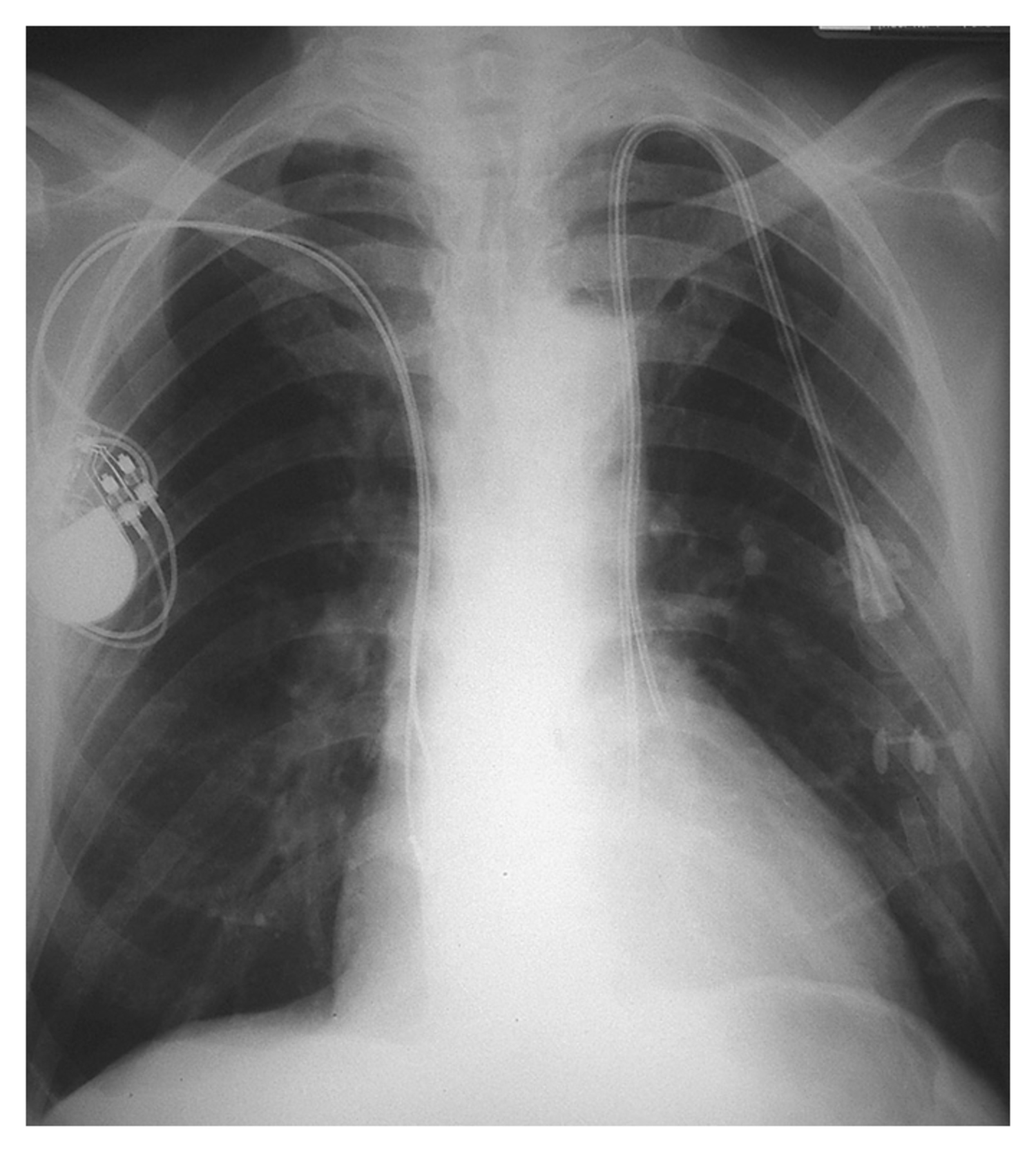 Image Challenge | The New England Journal of Medicine