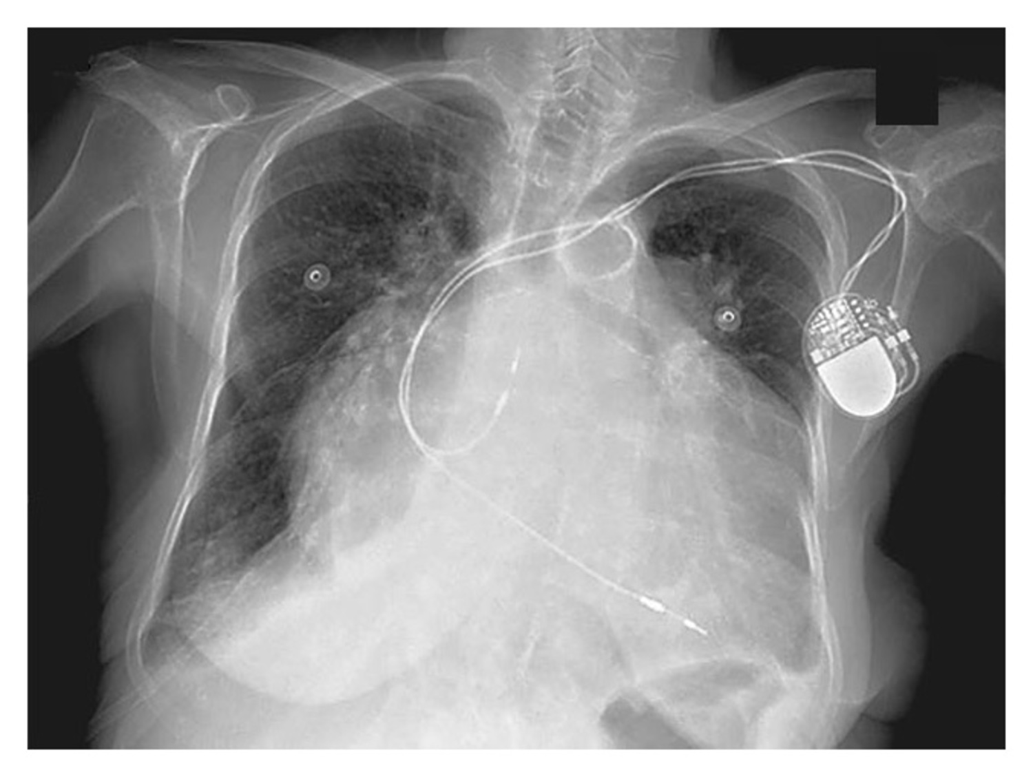 Image Challenge | The New England Journal of Medicine