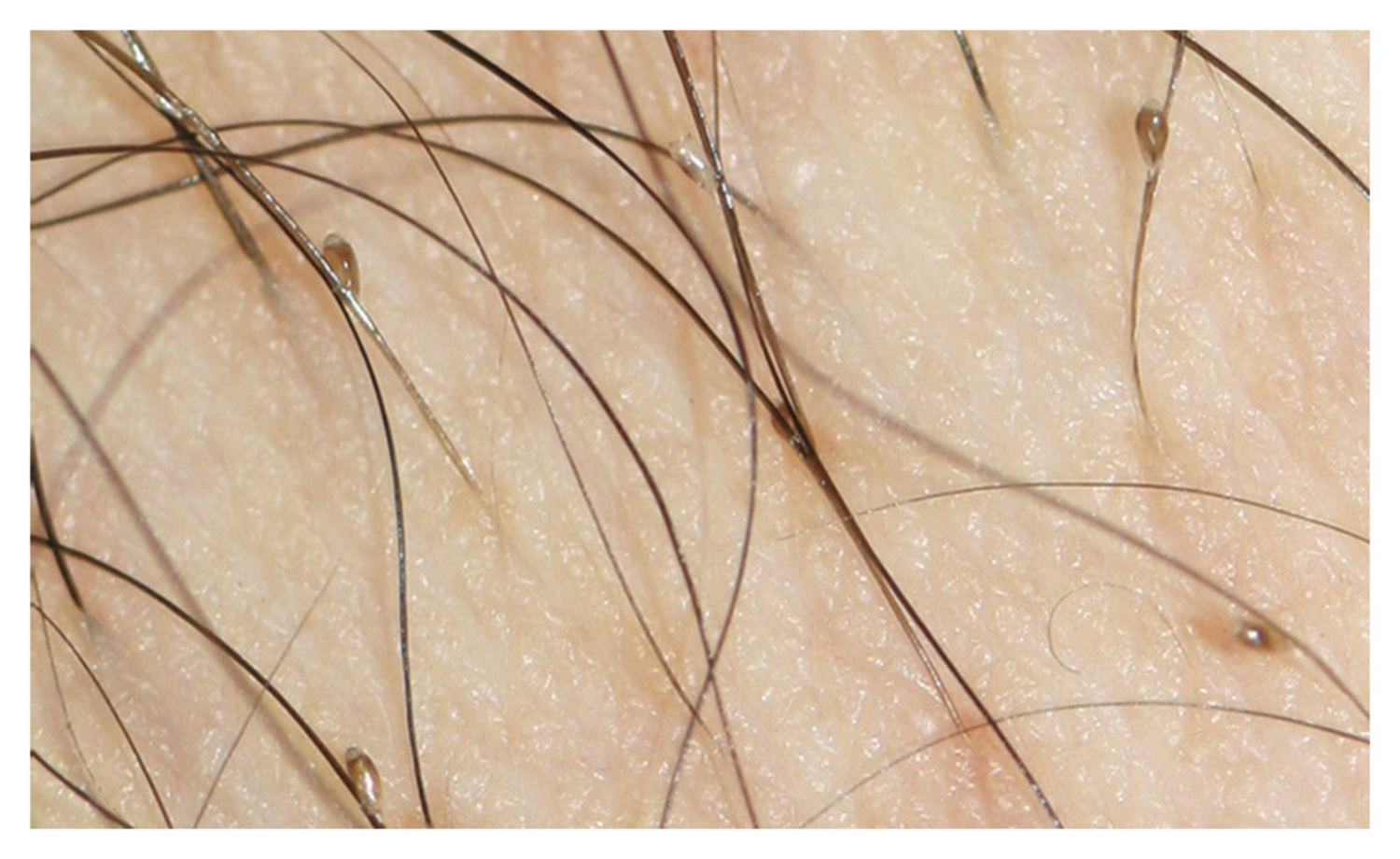 Image Challenge | The New England Journal of Medicine