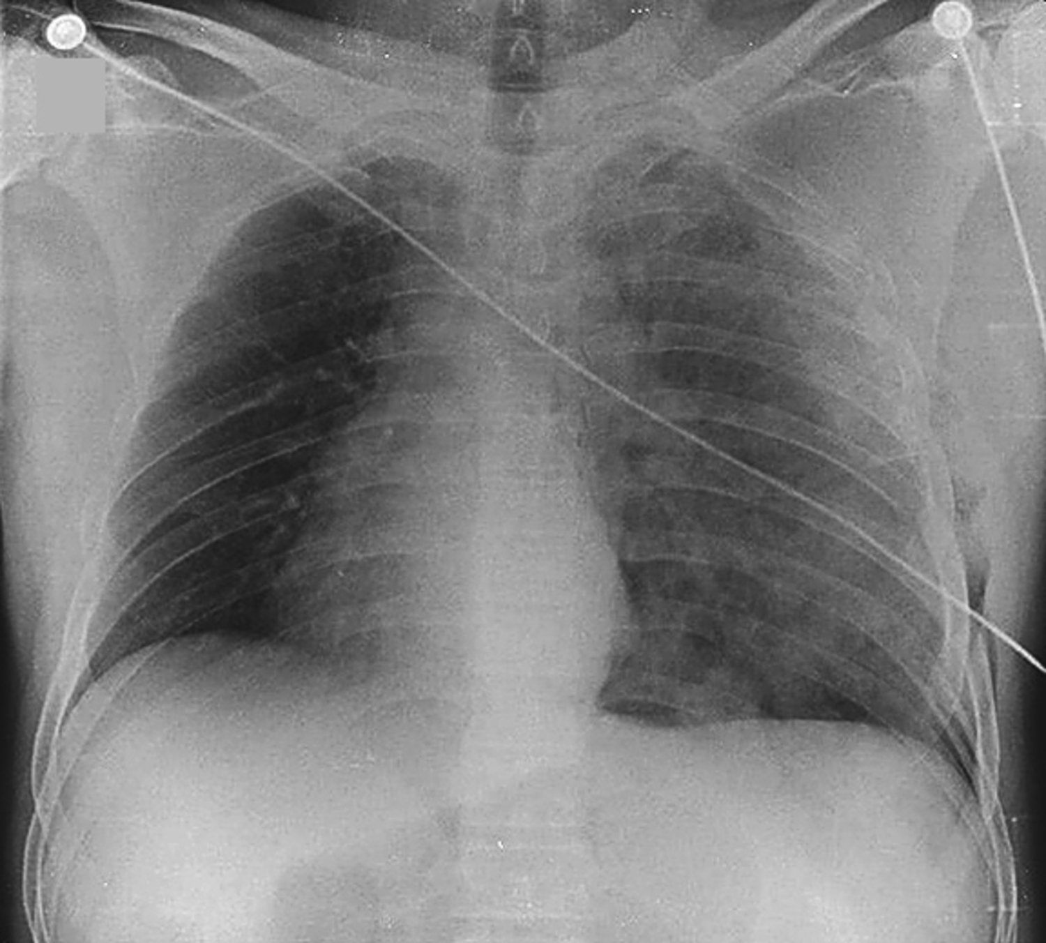 Image Challenge | The New England Journal of Medicine