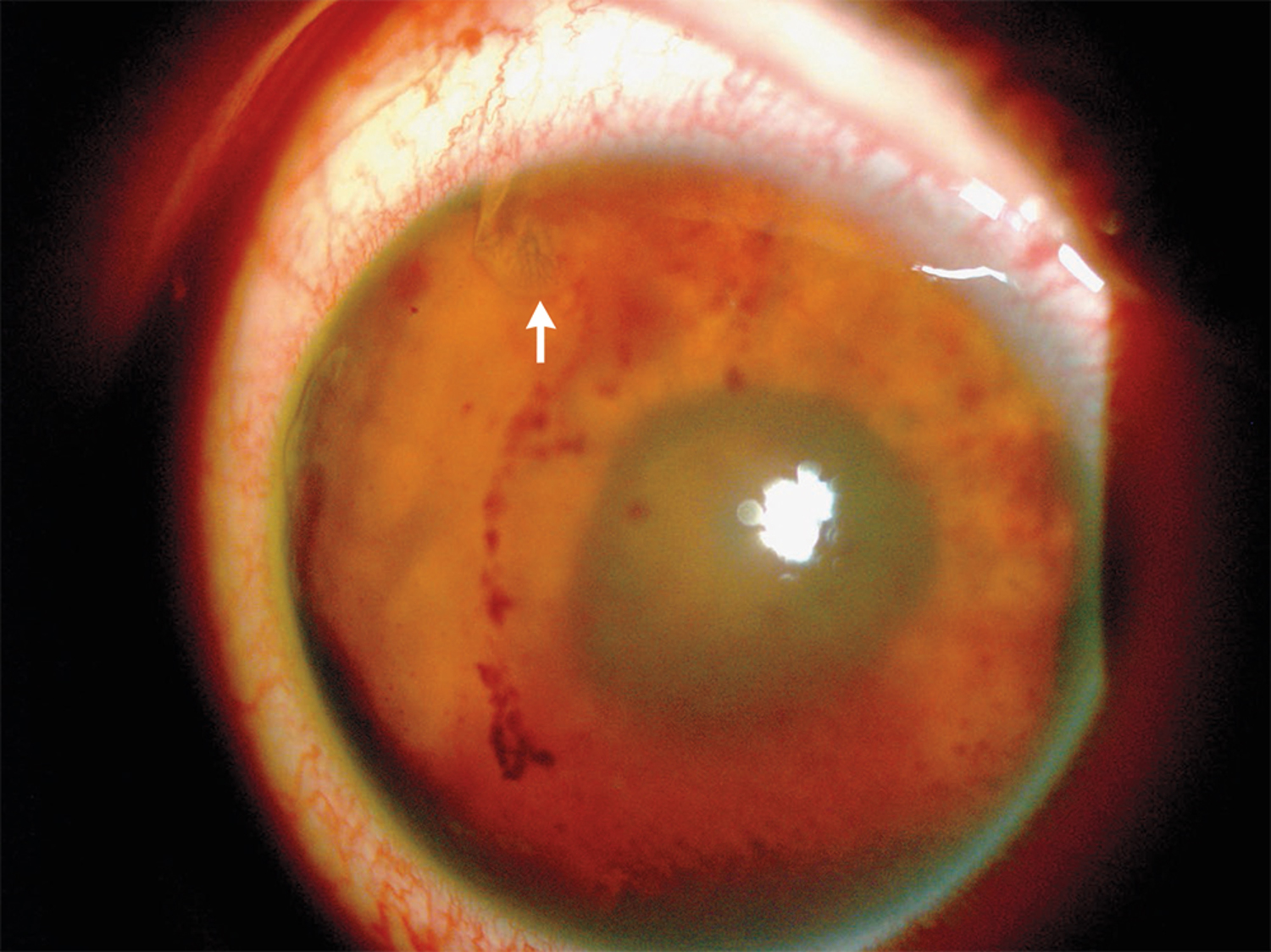 Image Challenge | The New England Journal of Medicine