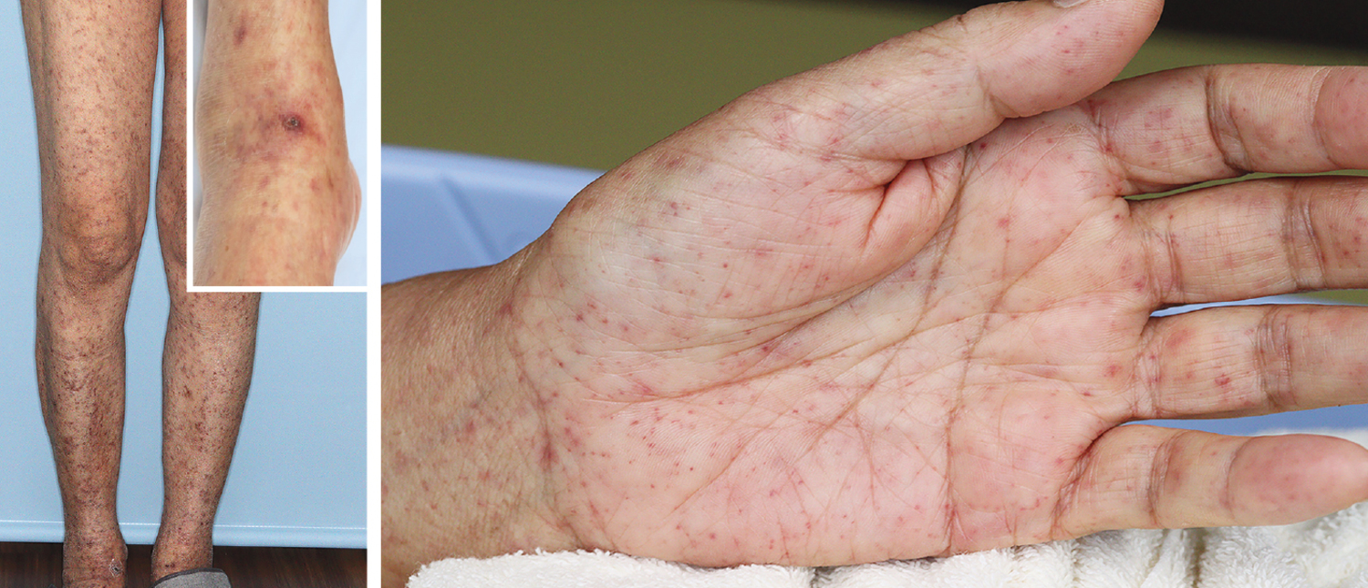 Image Challenge | NEJM