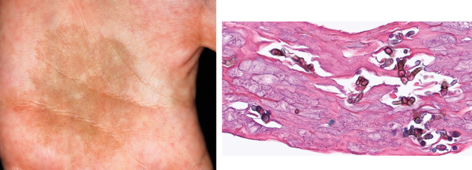 Image Challenge | The New England Journal of Medicine