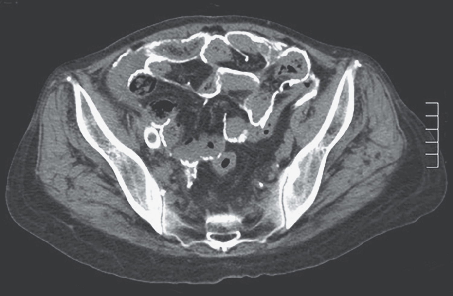 Image Challenge | NEJM