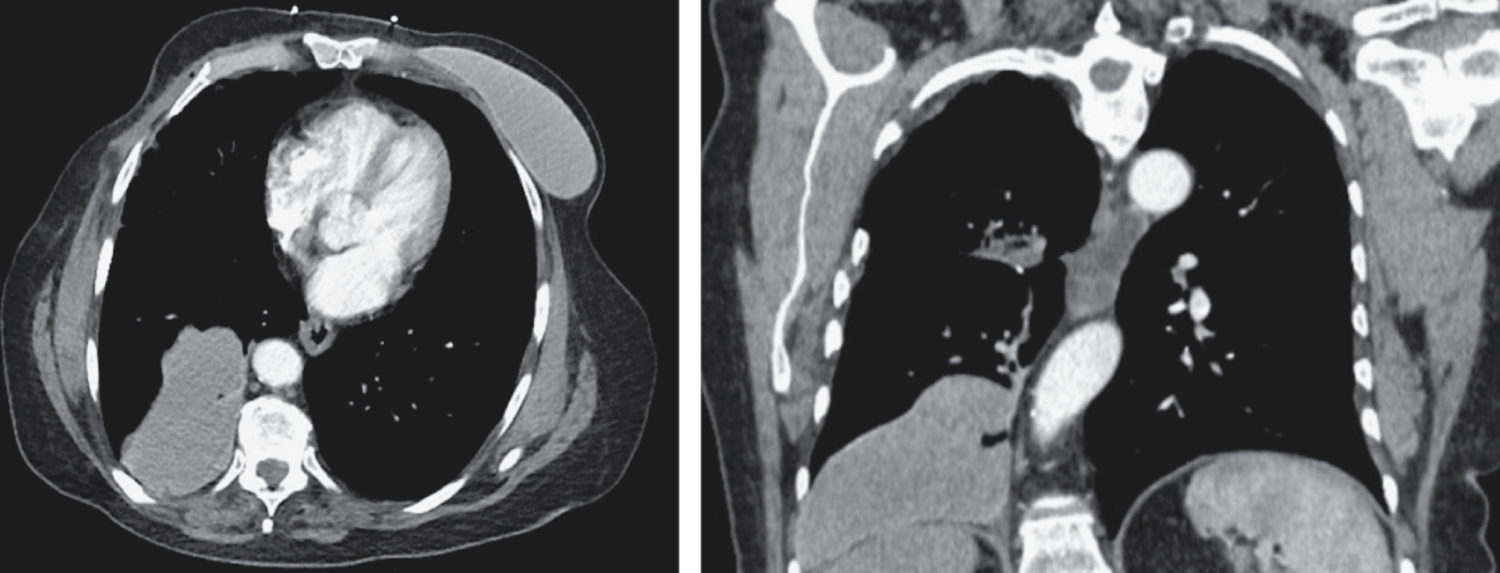 Image Challenge | The New England Journal of Medicine