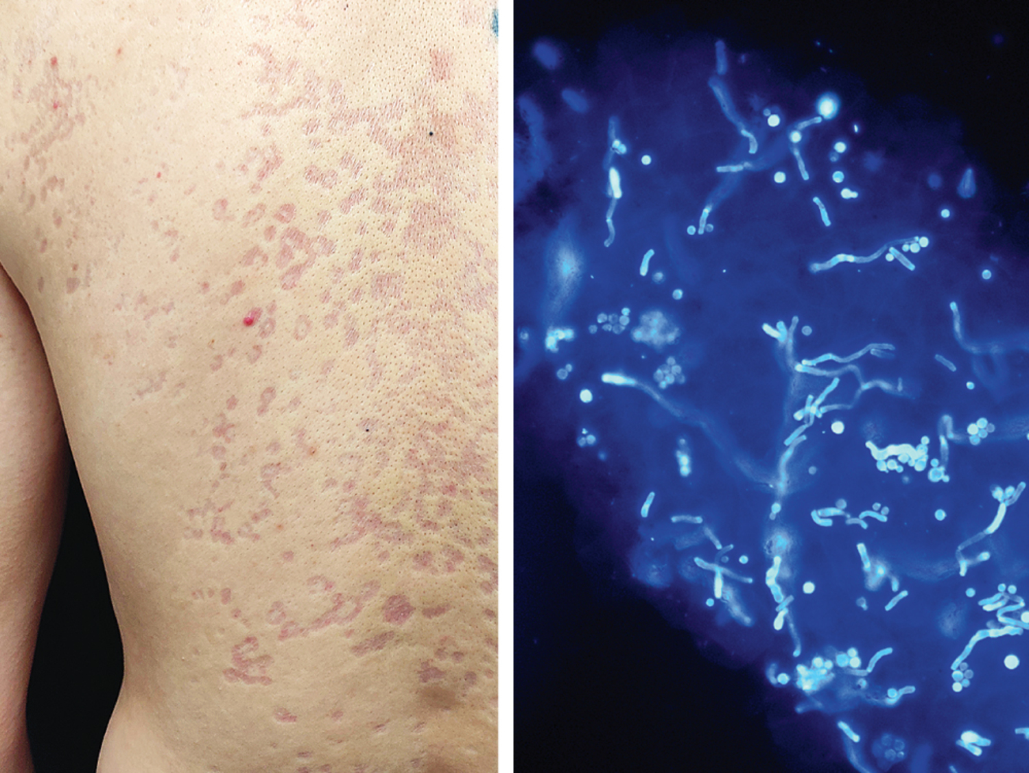 Image Challenge | The New England Journal of Medicine