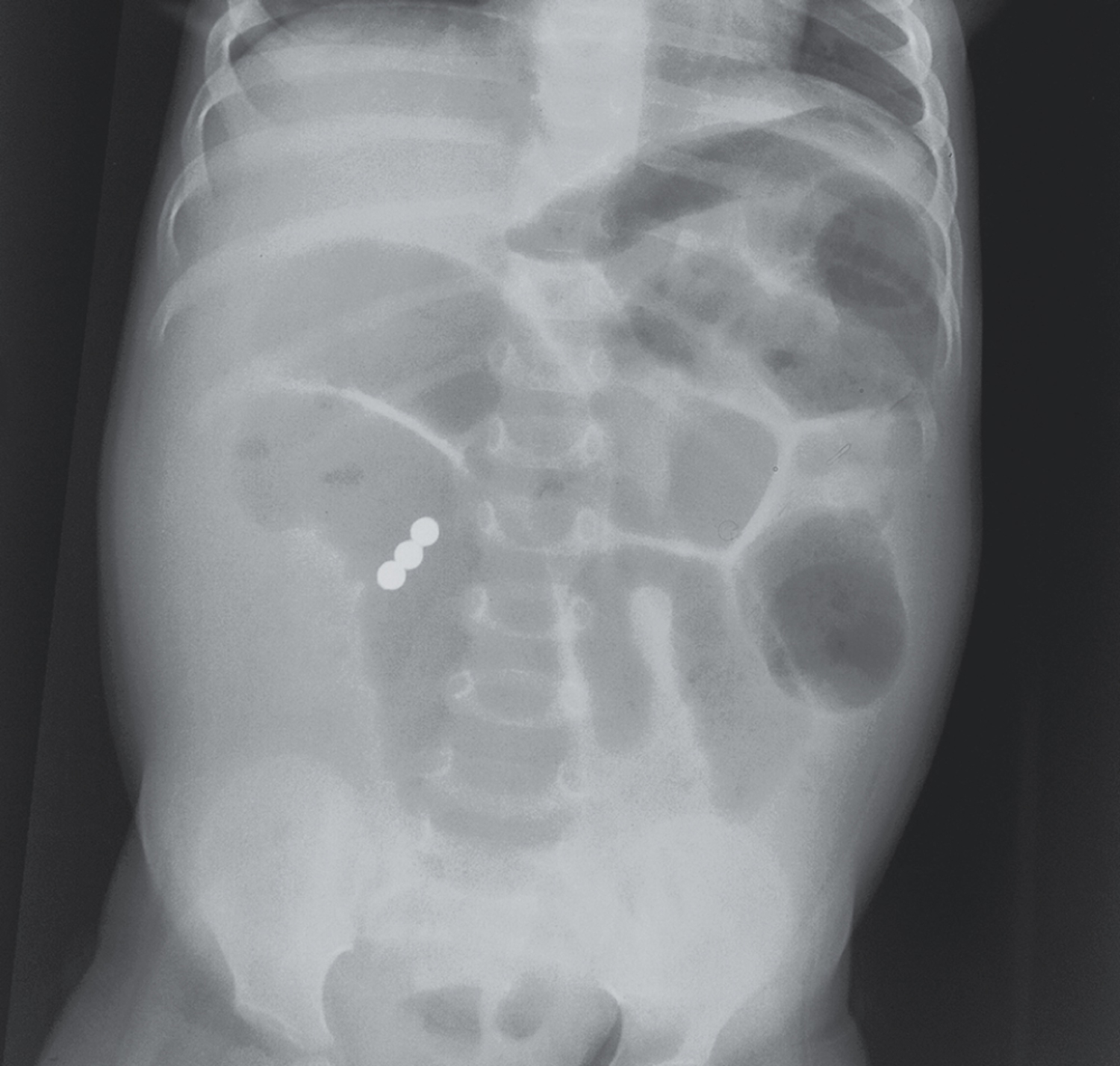 Image Challenge | The New England Journal of Medicine