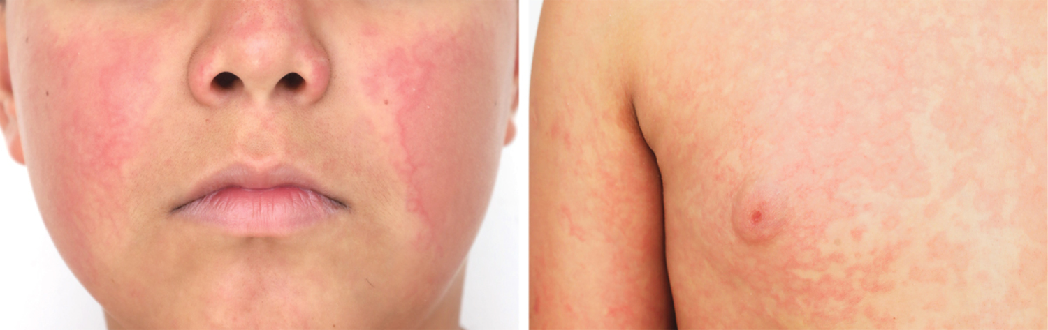 Image Challenge | The New England Journal of Medicine