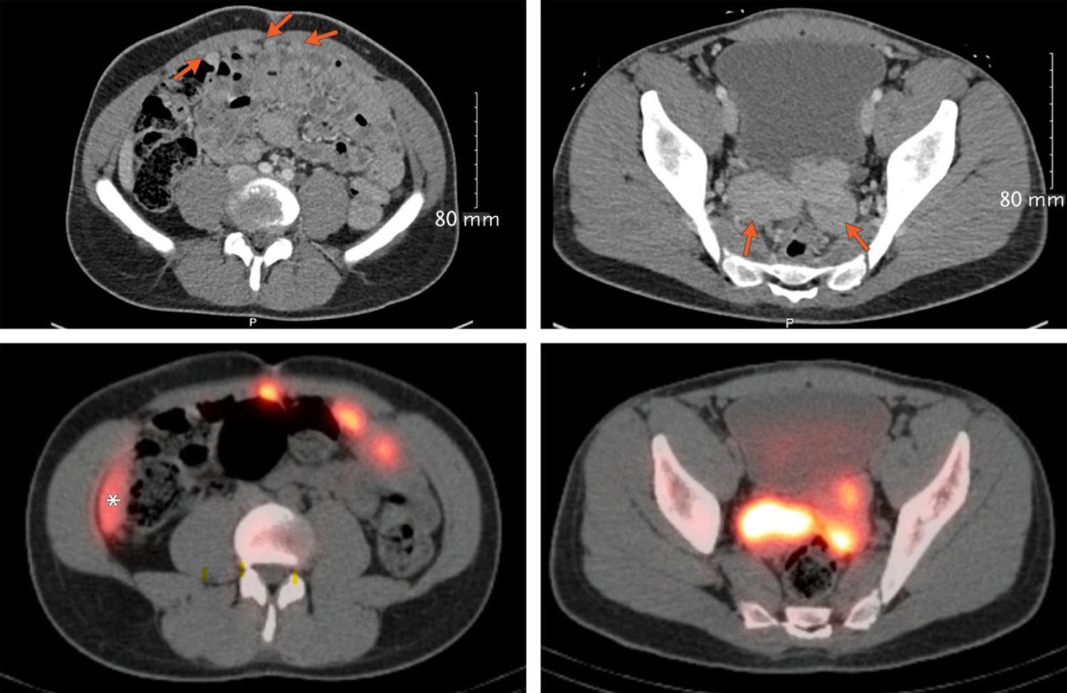 Image Challenge | The New England Journal of Medicine
